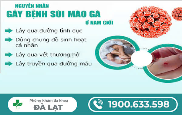 Hình ảnh minh họa