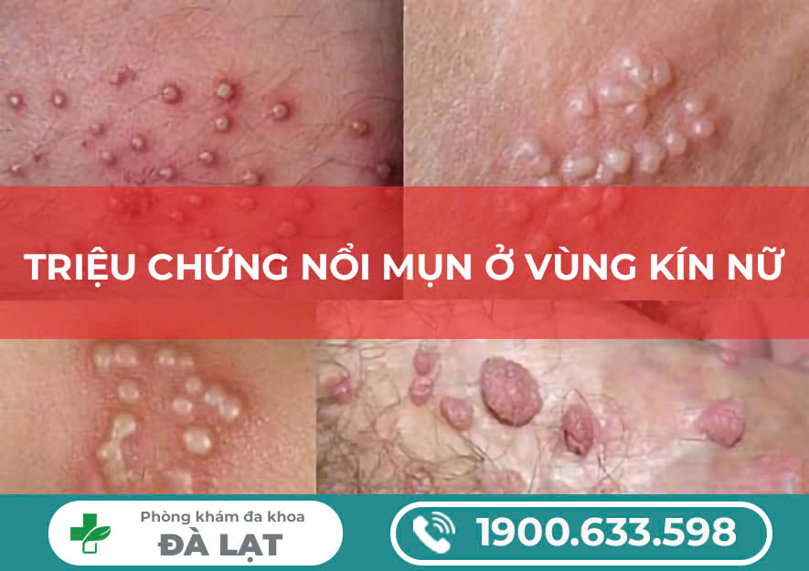 Hình ảnh minh họa