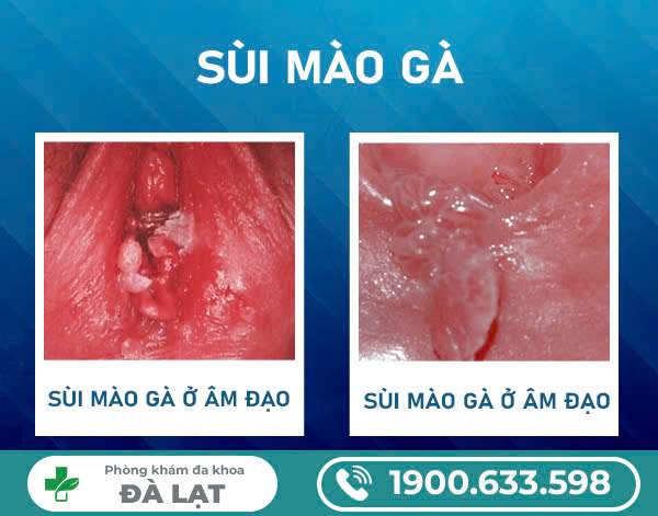 Hình ảnh minh họa