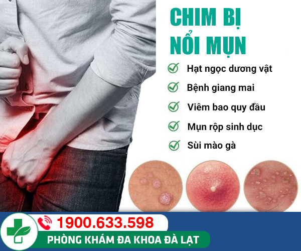 Hình ảnh minh họa