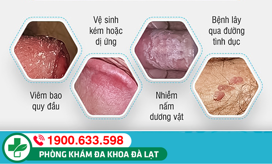 Hình ảnh minh họa