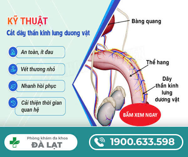Hình ảnh minh họa
