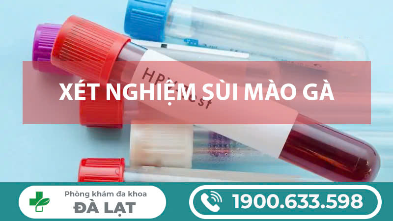 Hình ảnh minh họa