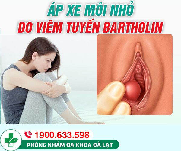 Hình ảnh minh họa