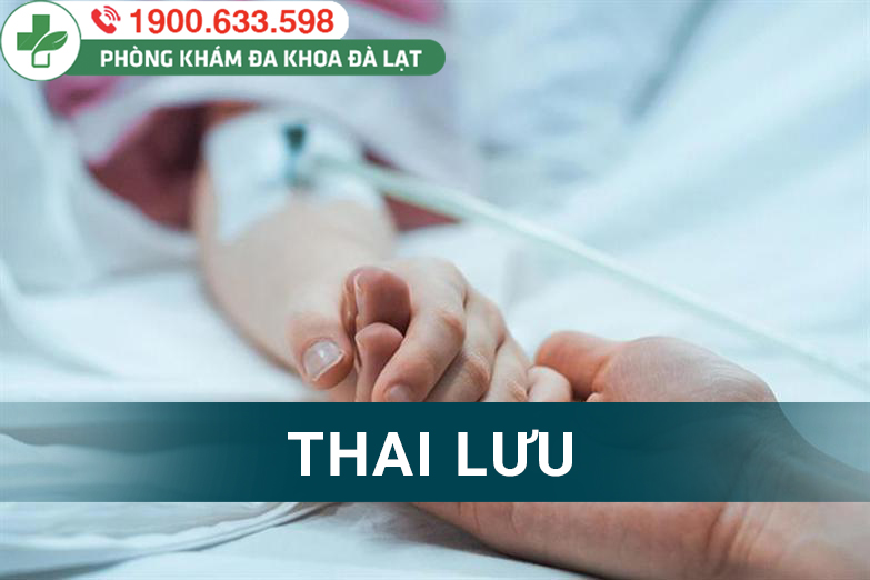 Hình ảnh minh họa