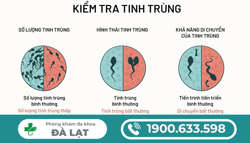 Hình ảnh minh họa