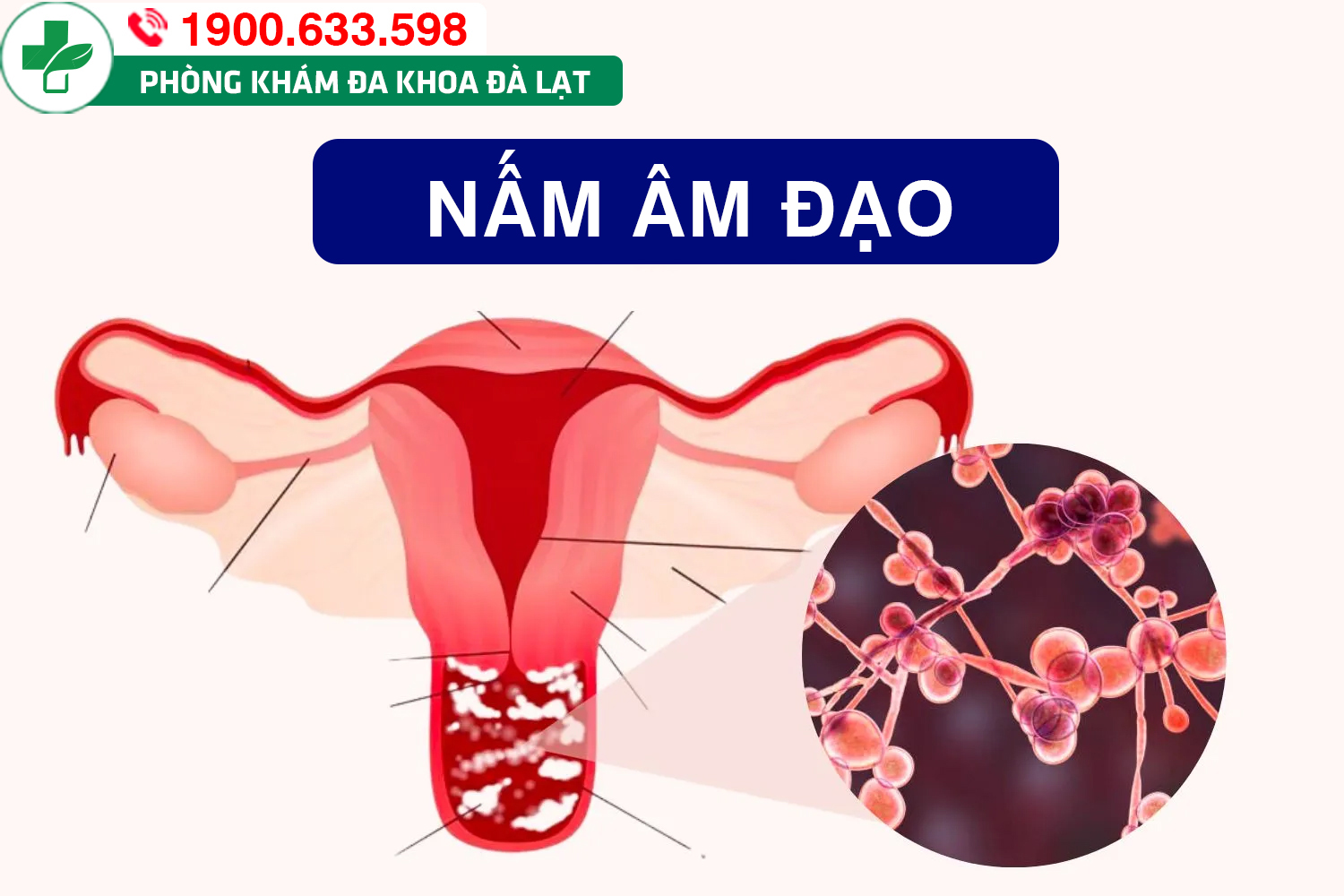 Hình ảnh minh họa