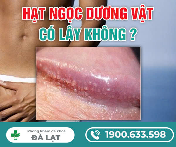 Hình ảnh minh họa