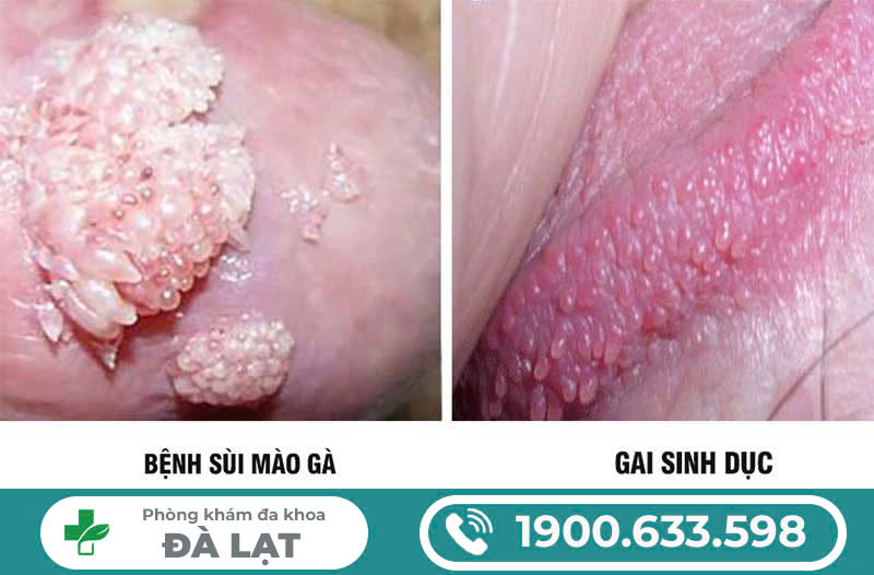 Hình ảnh minh họa