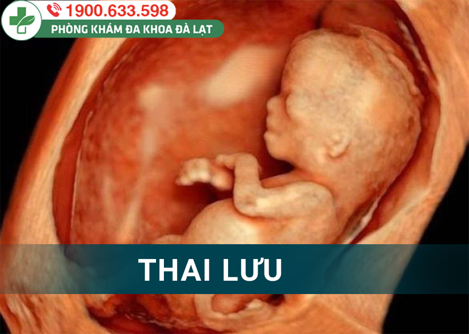 Hình ảnh minh họa